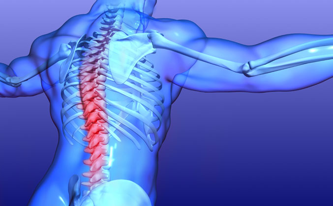 Acute spinal cord injury