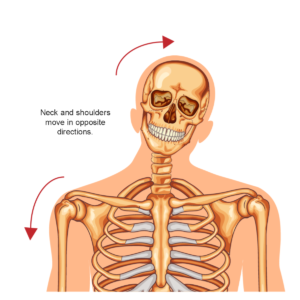 Brachial-Plexus-Injury Brachial-Plexus-Injury