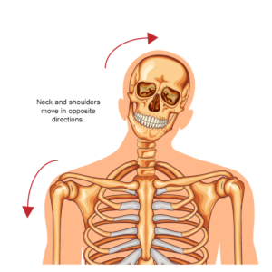 Brachial-Plexus-Injury