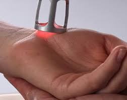 LASER- RANCHI PHYSIOTHERAPY LASER- RANCHI PHYSIOTHERAPY