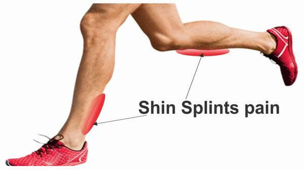 Shin Pain Shin Pain