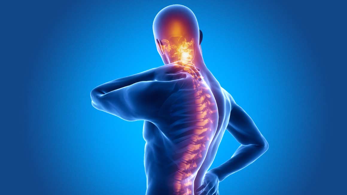 Spondylitis Spondylitis