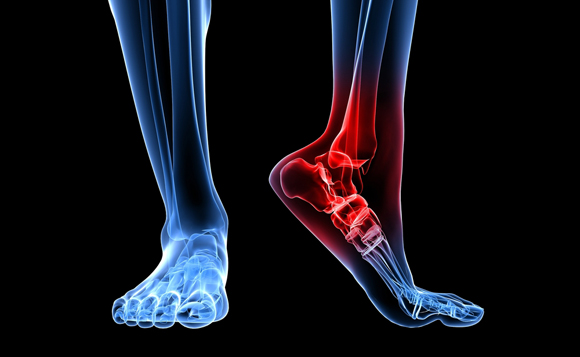 ankle pain ankle pain